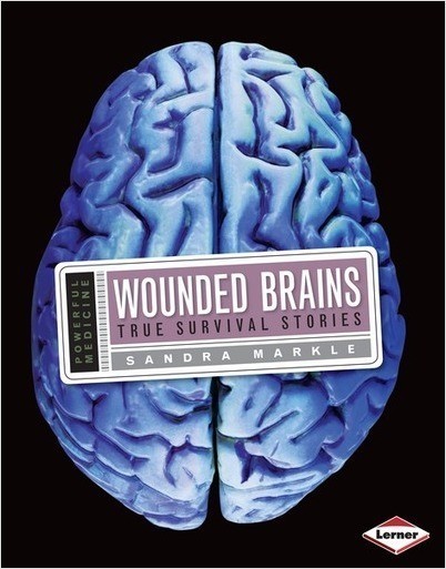Wounded Brains: True Survival Stories